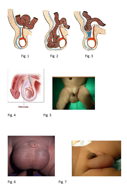 região-inguinal